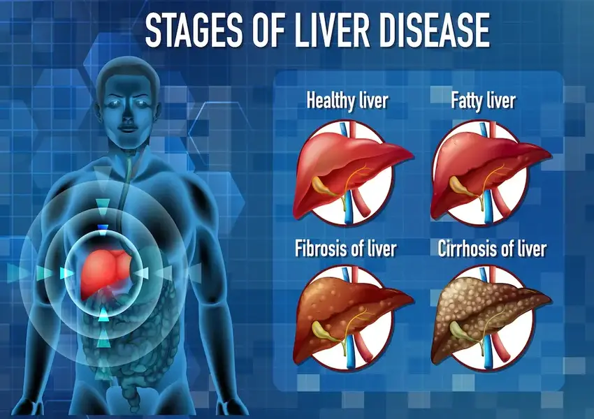If you see these symptoms, understand that your liver is bad